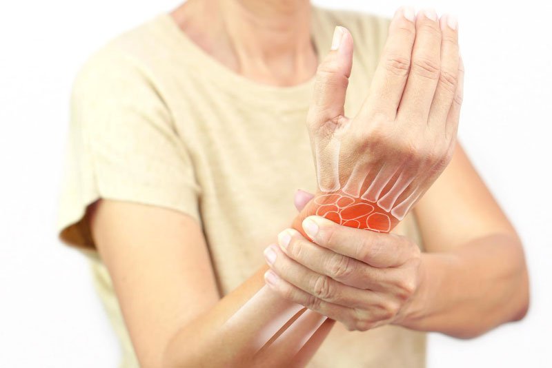 Carpal Tunnel Syndrome Care