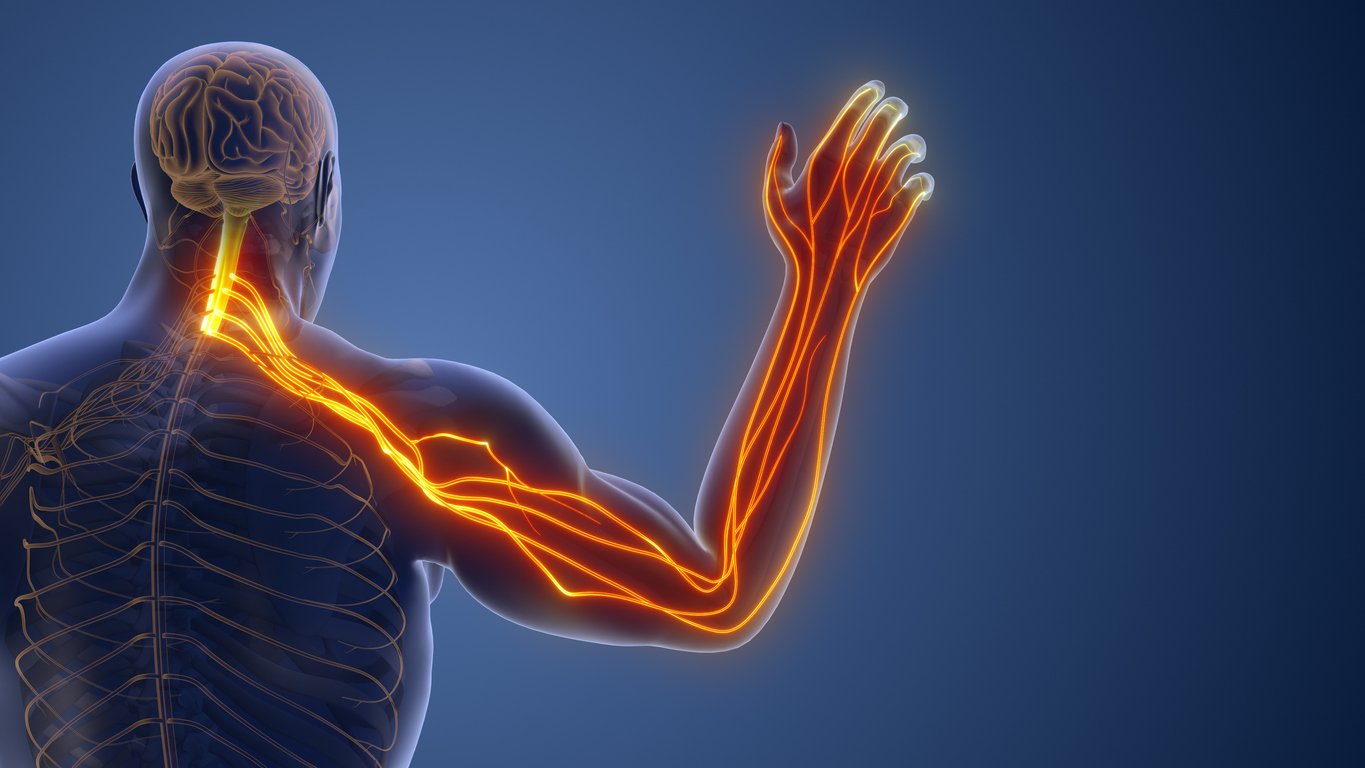 Radiculopathy Treatment Bhopal